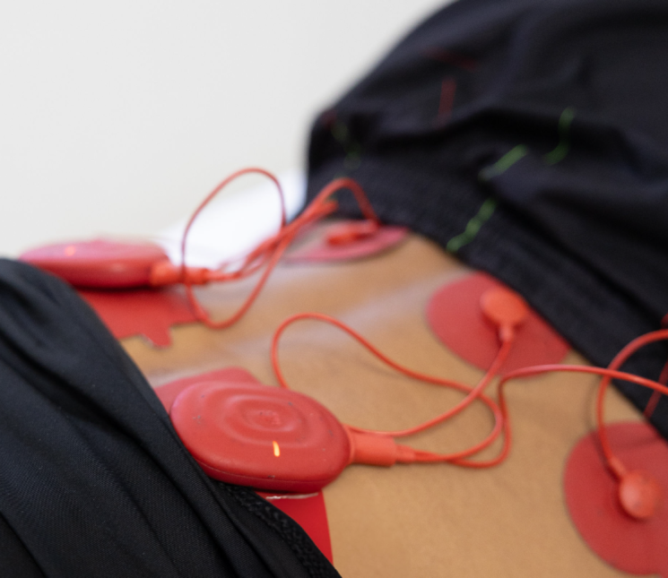 Estimulación
